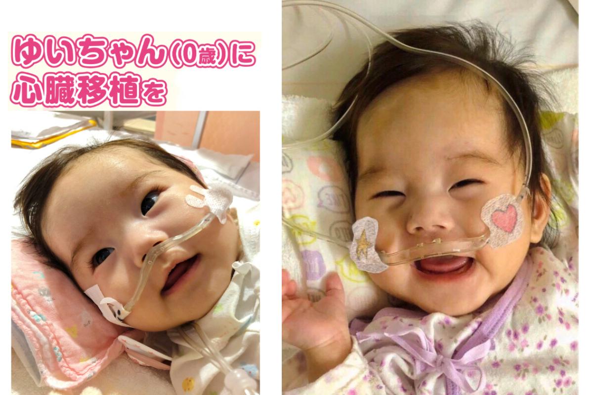 生後1ヶ月で重い心臓病を患ってしまった「ゆいちゃん」に心臓移植手術をの画像