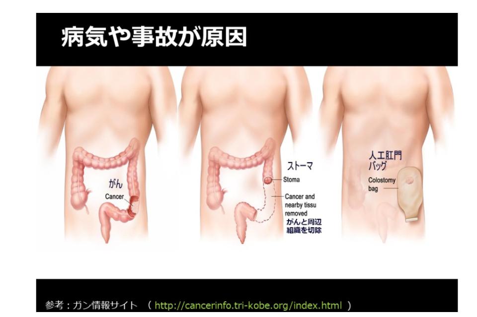 Why we are tackling this issue Image